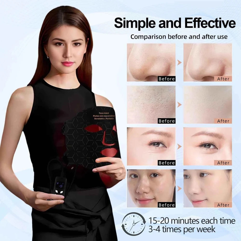 Maschera viso a luminoterapia LED